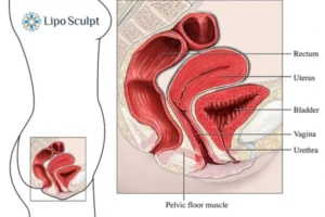Treatment For A Leaky Bladder 2 How EM Chair treatment Croxton can help Leaky bladder issues. Read more now!