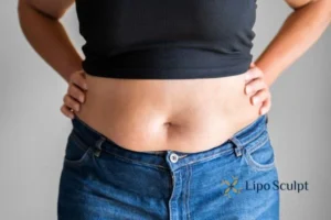 Bidding Farewell to Muffin Tops with Aqualyx Fat Injections 2 Do you wish you could reduce your muffin top Croxton With Aqualy fat dissolving injections you can!